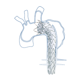 Talos®直管型胸主动脉覆膜支架系统